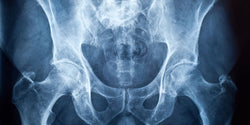 Action Mesothelioma Day: It Doesn't Just Affect Your Lungs